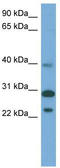 Coiled-Coil Domain Containing 28A antibody, TA333821, Origene, Western Blot image 