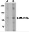Lysine Demethylase 4A antibody, 5373, ProSci Inc, Western Blot image 