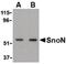 SKI Like Proto-Oncogene antibody, PA5-20306, Invitrogen Antibodies, Western Blot image 