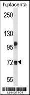 Fibulin 1 antibody, 57-902, ProSci, Western Blot image 