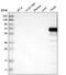 HERV-R_7q21.2 provirus ancestral Env polyprotein antibody, NBP2-62602, Novus Biologicals, Western Blot image 