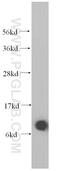 Small Nuclear Ribonucleoprotein Polypeptide G antibody, 15084-1-AP, Proteintech Group, Western Blot image 