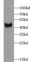 XK Related 6 antibody, FNab09544, FineTest, Western Blot image 