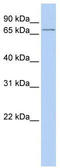 Arachidonate 15-Lipoxygenase Type B antibody, TA346276, Origene, Western Blot image 