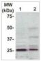 Rho GDP-dissociation inhibitor 1 antibody, OAAI00735, Aviva Systems Biology, Western Blot image 