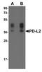 B7-DC antibody, TA355061, Origene, Western Blot image 