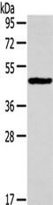 Interleukin-3 receptor subunit alpha antibody, TA350697, Origene, Western Blot image 