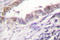 Cyclin A  antibody, LS-C175983, Lifespan Biosciences, Immunohistochemistry paraffin image 