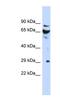 Defective In Cullin Neddylation 1 Domain Containing 3 antibody, NBP1-55387, Novus Biologicals, Western Blot image 