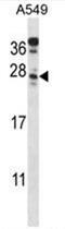 Mitochondria Localized Glutamic Acid Rich Protein antibody, AP50639PU-N, Origene, Western Blot image 