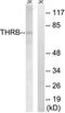 F2 antibody, LS-B9280, Lifespan Biosciences, Western Blot image 