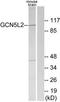 Histone acetyltransferase KAT2A antibody, TA313917, Origene, Western Blot image 
