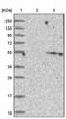 Cytochrome P450 Family 2 Subfamily W Member 1 antibody, PA5-52979, Invitrogen Antibodies, Western Blot image 