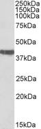 Troponin T2, Cardiac Type antibody, TA348993, Origene, Western Blot image 