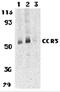 C-C Motif Chemokine Receptor 3 antibody, 1105, ProSci, Western Blot image 