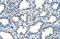 Epithelial Membrane Protein 2 antibody, NBP1-62705, Novus Biologicals, Immunohistochemistry paraffin image 
