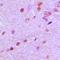 Neuronal Differentiation 2 antibody, orb214302, Biorbyt, Immunohistochemistry paraffin image 