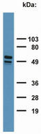 Keratin-7 antibody, SM3046P, Origene, Western Blot image 