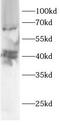 ADP Ribosylation Factor Like GTPase 13B antibody, FNab10390, FineTest, Western Blot image 