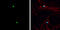 HASH1 antibody, GTX133105, GeneTex, Immunofluorescence image 