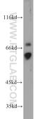 Fc Fragment Of IgA Receptor antibody, 13245-1-AP, Proteintech Group, Western Blot image 