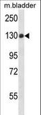 Protein Tyrosine Phosphatase Non-Receptor Type 14 antibody, LS-C162302, Lifespan Biosciences, Western Blot image 