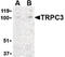Transient Receptor Potential Cation Channel Subfamily C Member 3 antibody, LS-B186, Lifespan Biosciences, Western Blot image 