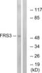 Fibroblast Growth Factor Receptor Substrate 3 antibody, abx014001, Abbexa, Western Blot image 