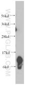 Cytochrome b-c1 complex subunit 8 antibody, 14975-1-AP, Proteintech Group, Western Blot image 