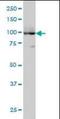 ATPase Sarcoplasmic/Endoplasmic Reticulum Ca2+ Transporting 3 antibody, orb95015, Biorbyt, Western Blot image 