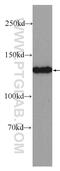 Phosphorylase Kinase Regulatory Subunit Alpha 2 antibody, 24658-1-AP, Proteintech Group, Western Blot image 