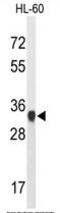 ATP Synthase F1 Subunit Gamma antibody, AP50298PU-N, Origene, Western Blot image 