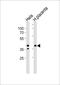 Isocitrate Dehydrogenase (NAD(+)) 3 Beta antibody, PA5-49334, Invitrogen Antibodies, Western Blot image 