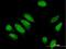 Phosphodiesterase 4D Interacting Protein antibody, H00009659-B01P, Novus Biologicals, Immunocytochemistry image 