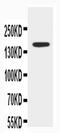 ATP Binding Cassette Subfamily B Member 4 antibody, PA5-78691, Invitrogen Antibodies, Western Blot image 