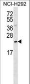 PRELI Domain Containing 3B antibody, LS-C161293, Lifespan Biosciences, Western Blot image 