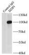DAZ Interacting Zinc Finger Protein 1 antibody, FNab02598, FineTest, Immunoprecipitation image 
