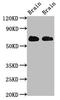 Excitatory amino acid transporter 2 antibody, LS-C670148, Lifespan Biosciences, Western Blot image 