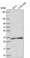 Synaptosomal-associated protein 29 antibody, PA5-66017, Invitrogen Antibodies, Western Blot image 