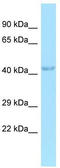 RNA Binding Motif Protein 48 antibody, TA343948, Origene, Western Blot image 