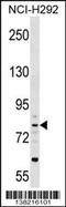 Cartilage Acidic Protein 1 antibody, 59-634, ProSci, Western Blot image 