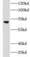 Chondroitin Sulfate Synthase 1 antibody, FNab01699, FineTest, Western Blot image 