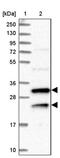 Multivesicular Body Subunit 12A antibody, PA5-59772, Invitrogen Antibodies, Western Blot image 