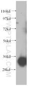 NADH-cytochrome b5 reductase 1 antibody, 11807-1-AP, Proteintech Group, Western Blot image 