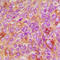 Raf-1 Proto-Oncogene, Serine/Threonine Kinase antibody, LS-C368526, Lifespan Biosciences, Immunohistochemistry paraffin image 