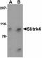 SLIT And NTRK Like Family Member 4 antibody, orb74940, Biorbyt, Western Blot image 
