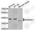 Deoxyribonuclease-1 antibody, A2537, ABclonal Technology, Western Blot image 