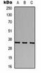 Calcium Voltage-Gated Channel Auxiliary Subunit Gamma 2 antibody, orb323237, Biorbyt, Western Blot image 