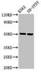 Glycoprotein A33 antibody, CSB-PA857459EA01HU, Cusabio, Western Blot image 
