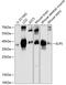 Elongator Acetyltransferase Complex Subunit 5 antibody, GTX66300, GeneTex, Western Blot image 
